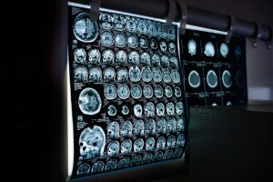 自律神経の乱れが引き起こす不眠の対策方法は？